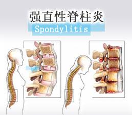 南京强脊诊疗中心