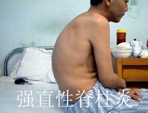 南京强脊诊疗中心